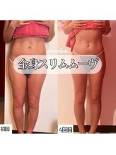 エモーション(E Motion)/before→after☆