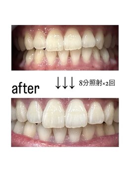 フラン(franc)/