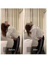 ナオル整体 新宿院(NAORU整体)/20代女性-猫背矯正Before/After
