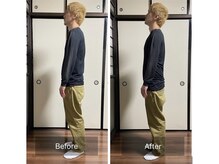 ミントのかべの整体院/姿勢矯正ビフォーアフター