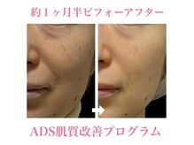 シャルメール 堀江(Charmer)の雰囲気（無添加化粧品のドクターリセラを使用。ADS認定エステサロン。）