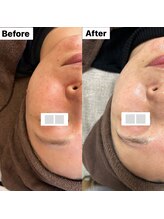 サロン サルー(SALON Salud)/◇再生美容