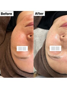 サロン サルー(SALON Salud)/◇再生美容