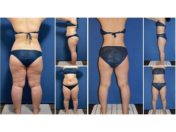 ピュアノア 垂水店