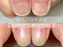 ル リアン 北浦和(le lien)/深爪育成(4ヶ月／6回)