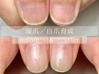 ル リアン 北浦和(le lien)/深爪育成(4ヶ月／6回)