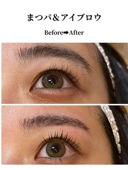 マックス(MAX)/大人の目元バランス調整