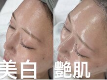 クラスペディア 嘉島店