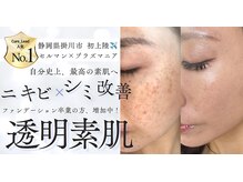 キュアリード(Cure_Lead)