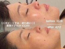 ソワン ド ブランシュ ライフ八戸ノ里店(Soin de Blanche)/酸素ケアメンテナンス