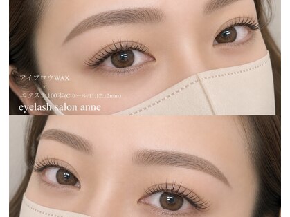 アン(anne)の写真