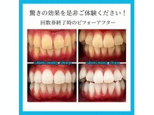 ホワイトニングショップ 徳島藍住店の雰囲気（【  驚きの白さをぜひご体感ください！】）