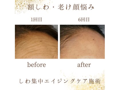 ア リトルエステ フェリスの写真