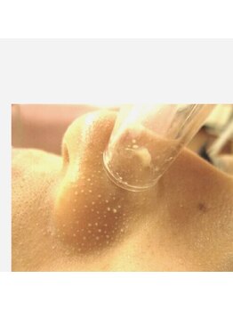 ローズマリー(RoseMarry)/オプションメニュー毛穴ケア