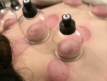 葉舞/施術イメージ16