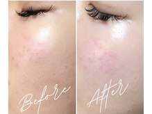 サロンリエム(Salon Riem.)/【美肌wax脱毛】