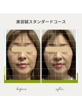 サロン ド ハリッシュ(Salon de HARISH)/トーンアップに◎