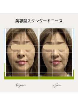 サロン ド ハリッシュ(Salon de HARISH)/トーンアップに◎