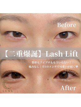 ルナ(LUNA)/【二重爆誕】