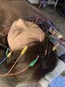 疲労回復したい方【免疫力UP】オーダーメイド頭皮鍼（60分)ヘッドスパ付き