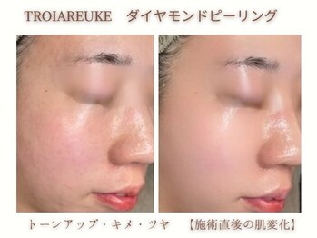 ミリ(MiLi)/トーンアップ・キメ・ツヤ