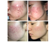 ビストレ スパ イオンタウン君津(美STRE SPA)の雰囲気（【韓国美肌管理サロン】美肌結果を求める方は是非お任せ下さい）