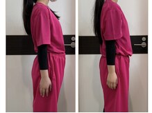 ギャラクシービューティー(galaxy beauty)/肩甲骨