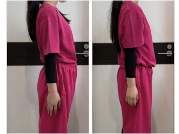 ギャラクシービューティー(galaxy beauty)/肩甲骨