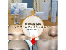 ナチュラルFの雰囲気（トラブル肌改善に特化♪生コラーゲンでシワがふわっと♪）