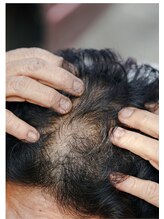 ザ レディービー(The Lady B)/ヘッドスパ