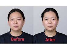 ほぐし手ただし手/WINBACKフェイシャル