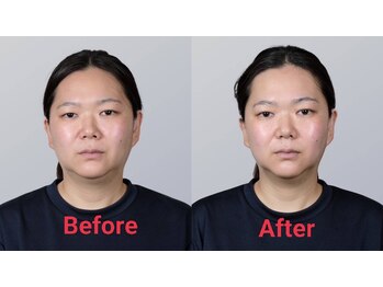 ほぐし手ただし手/WINBACKフェイシャル