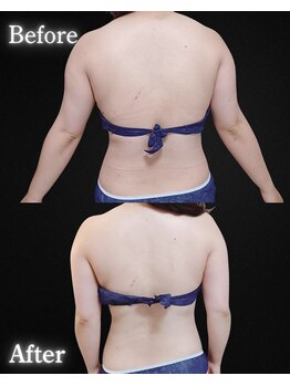 サンティエ(Santie)/ブライダルケア