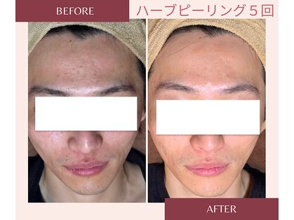 アブニールブリヨンの写真