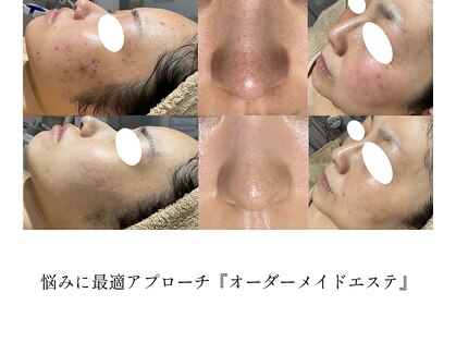 ラニエ(LANIE)の写真
