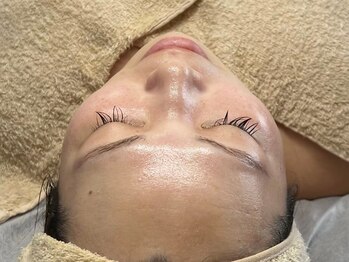 チョクチョクサロン(CHOKCHOK. Salon)/美顔器使用した毛穴ケアも大人気