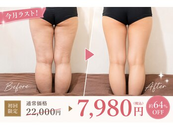 ビューティセレクト ビ プル(Be ple)の写真/パンツ姿に自信！スッキリ美脚を目指す★
気になる太もも・ヒップラインを徹底集中ケア♪