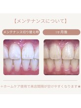 ホワイトニングカフェ 千葉店/メンテナンスでご利用可能♪