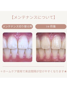 ホワイトニングカフェ 千葉店/メンテナンスでご利用可能♪