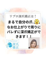 ブルームブルーム(BLOOMブルーム)/自爪風仕上げでバレずに深爪矯正