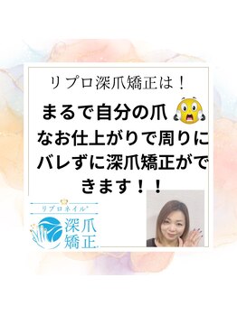ブルームブルーム(BLOOMブルーム)/自爪風仕上げでバレずに深爪矯正