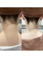 ヨシザワ インク 横浜みなとみらい桜木町店(YOSHIZAWA Inc.)&nbsp;産毛が無くなるだけで首元の印象UP