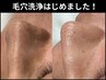 毛穴リセット洗浄【洗顔で届かない頑固な毛穴の黒ずみ汚れゴッソリオフ！】