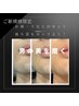 【10名様限定】ご新規様限定☆ヒゲ脱毛（お顔・うなじ含む）¥2,980