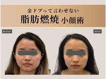 オーク ナチュリ 成城学園前(OAK×NACHUL)/新感覚の小顔エステ体験を♪