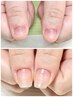 《ハンド/フット》深爪育成・自爪風仕上げ・長さ出しOK　120分　¥9900→8800