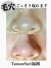 タマンサリ(Taman Sari)/頑固な毛穴汚れを大掃除