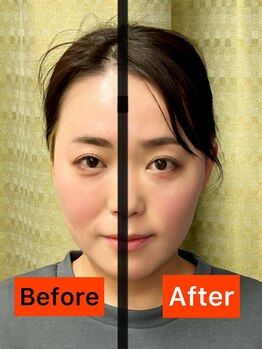 カラダ改善プロジェクト/フェイシャルビフォーアフター