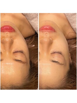 ビュウナ 銀座(BEAUNA)/シルクブライト