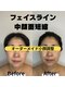 リル(LIL)の写真/【初回で効果を実感】表面だけでなく内側から引き上げでたるみ改善◎若々しい印象のお顔に導きます！